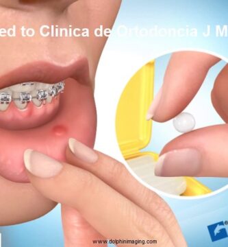 como funciona el para labios ortodoncia