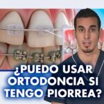 como puedes diferencial el cuarzo de una ortodoncia