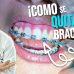 como quitar brackets de ortodoncia