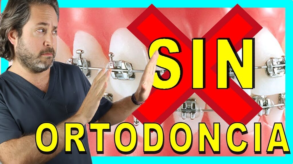 como tener dientes perfectos sin ortodoncia