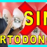 como tener dientes perfectos sin ortodoncia