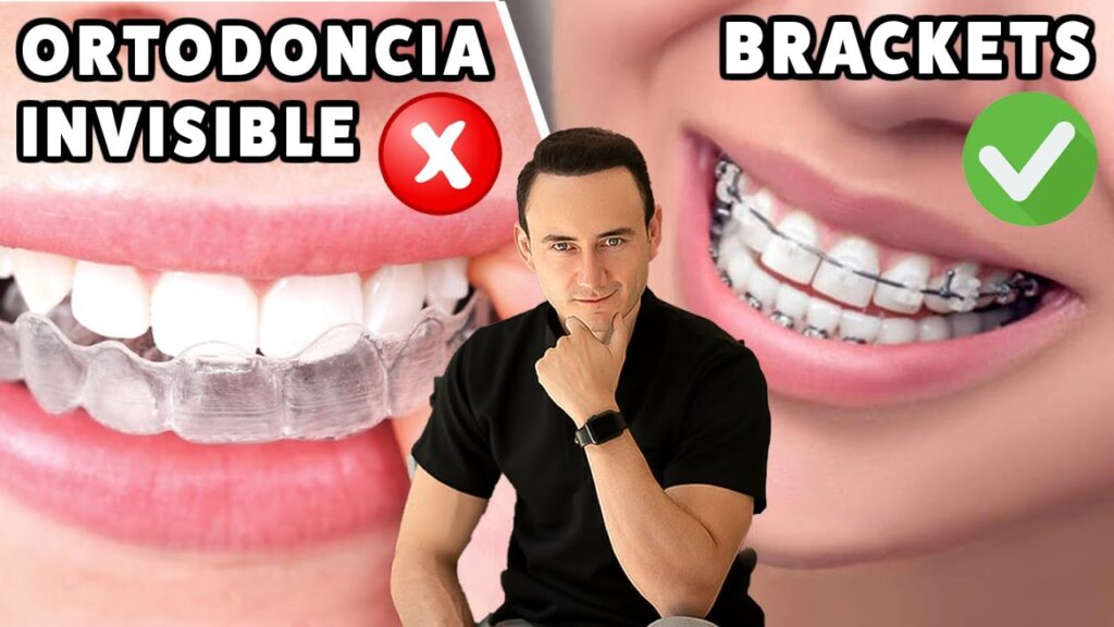 comparacion ortodoncia invisalign