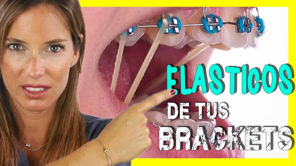 comprar bandas elasticas ortodoncia