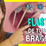 comprar bandas elasticas ortodoncia