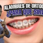 concepto de alambre de ortodoncia