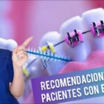 consejos primer dia ortodoncia