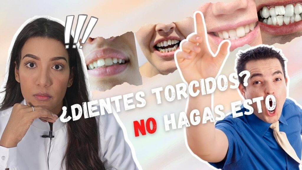 corregir dientes torcidos sin ortodoncia