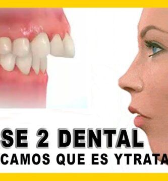 cuando corregir maloclusion dental clase 2 con ortodoncia adultos