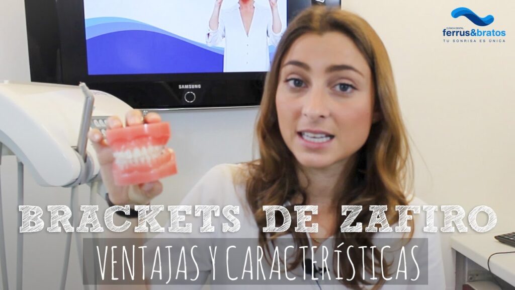 cuanto cuesta una ortodoncia con brackets de zafiro