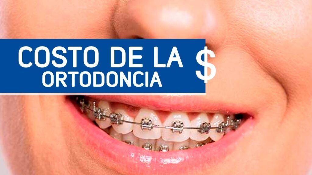 cuanto cuestan los brackets metálicos