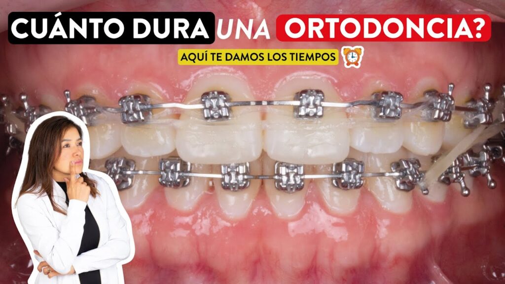 cuanto tiempo dura la carrera de ortodoncia