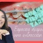 cuanto tiempo tarda en cerrar un diastema con ortodoncia