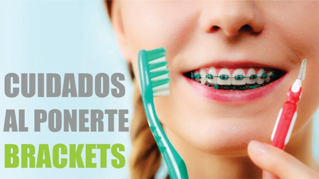 cuidados post ortodoncia