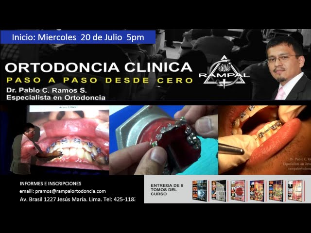 curso dioc ortodoncia