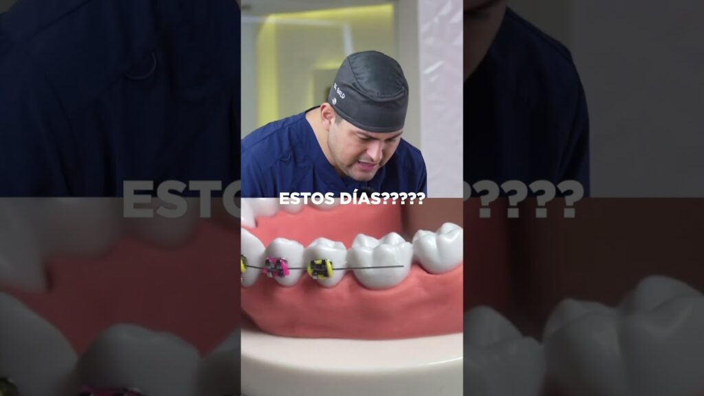 deformacion arcos ortodoncia