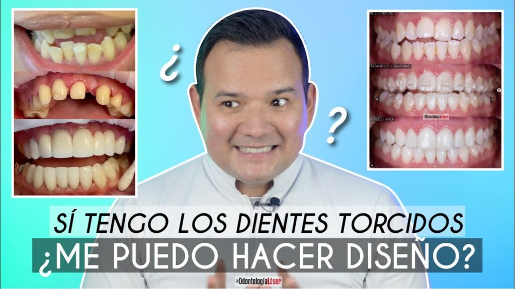 dentaduras deformes para hacerlas ortodoncias