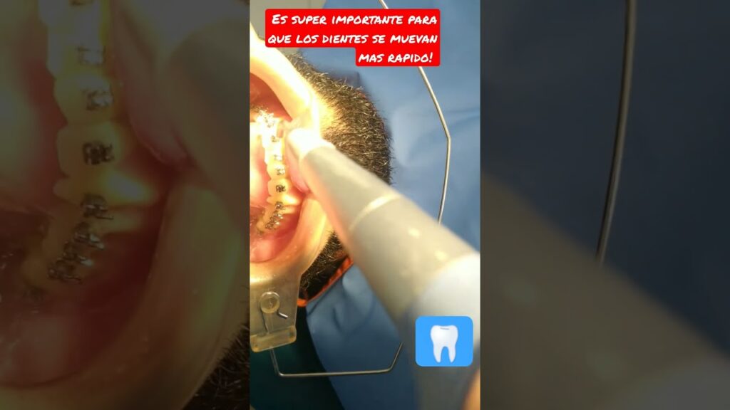 dental jet ortodoncia