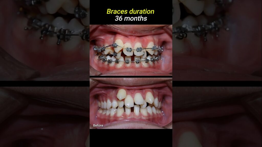 dental total ortodoncia