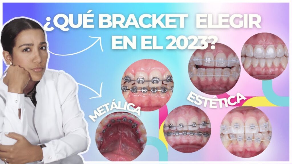 dentista ortodoncia tipos