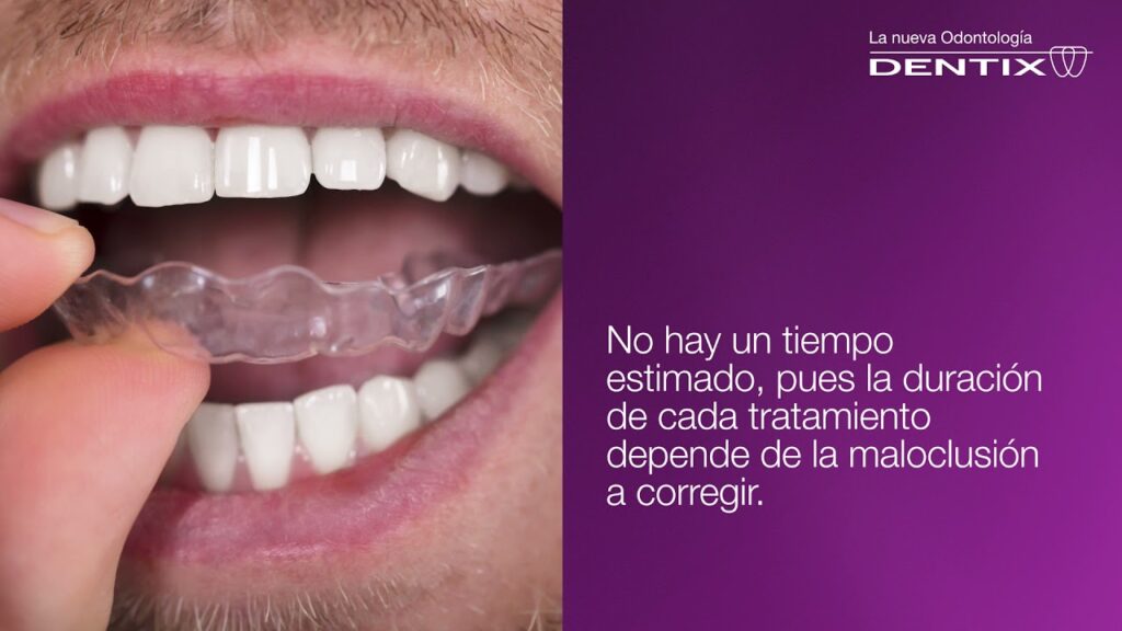 dentix ortodoncia invisible