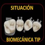 desrotar dientes ortodoncia