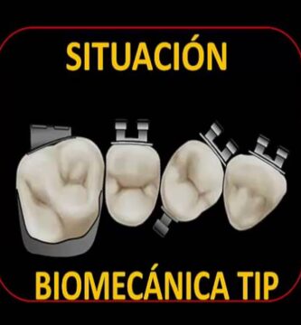 desrotar dientes ortodoncia