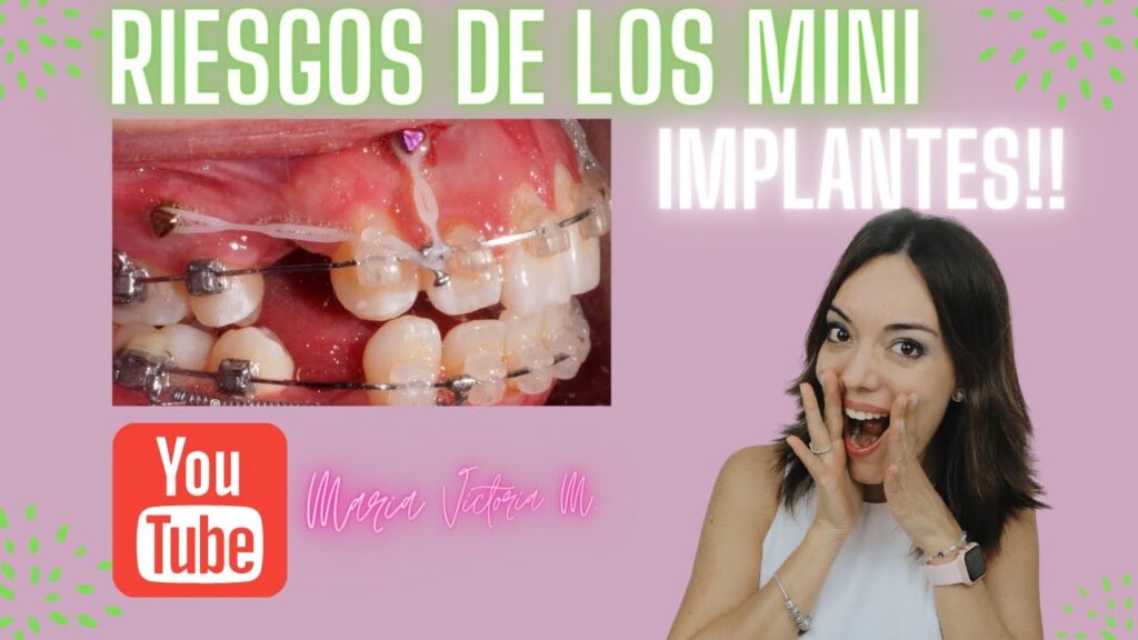 desventajas de los microimplantes en ortodoncia