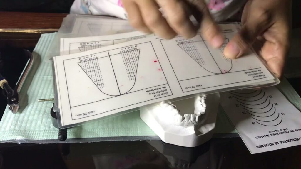 diagrama de moris ortodoncia