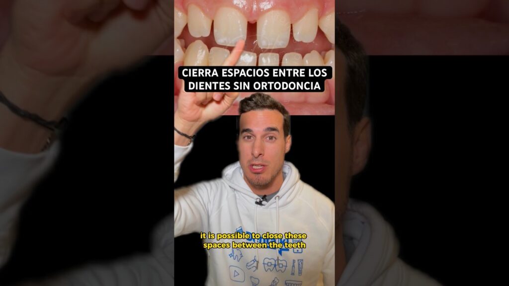 diastema ortodoncia cuanto dura