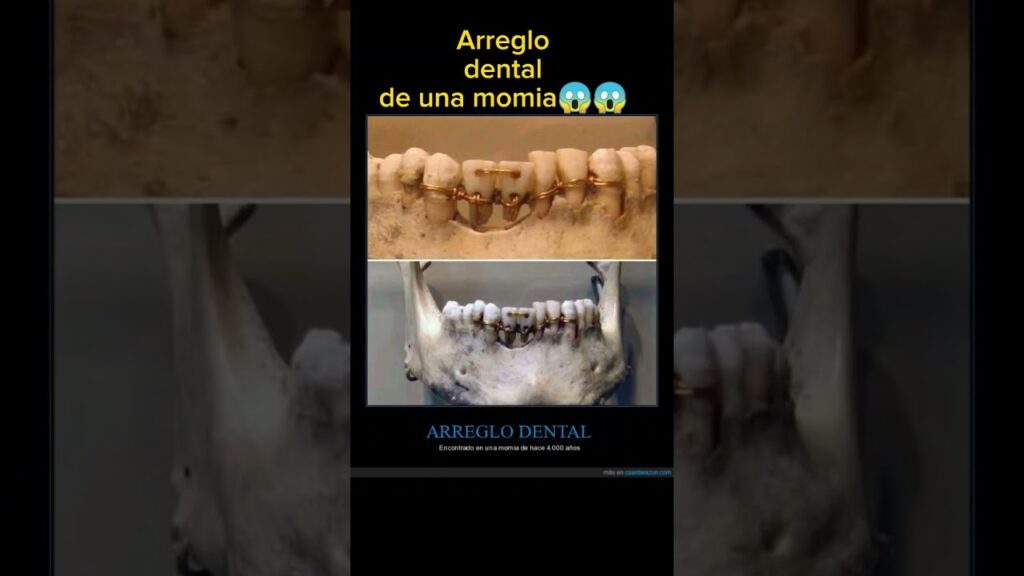 dientes ortodoncia momia