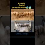 dientes ortodoncia momia