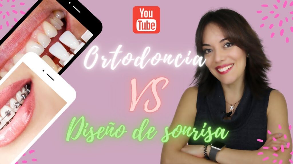 diferencia entre diseño de sonrisa y ortodoncia