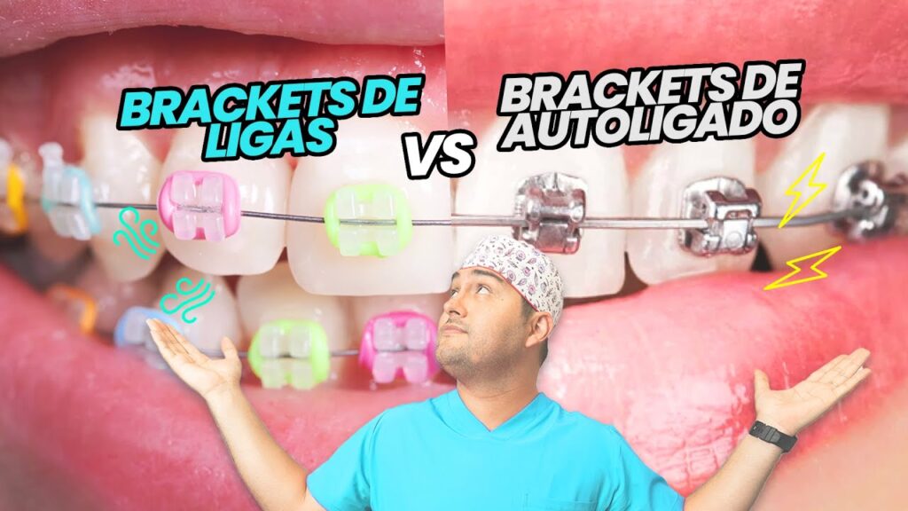 diferencia entre ortodoncia y brackets