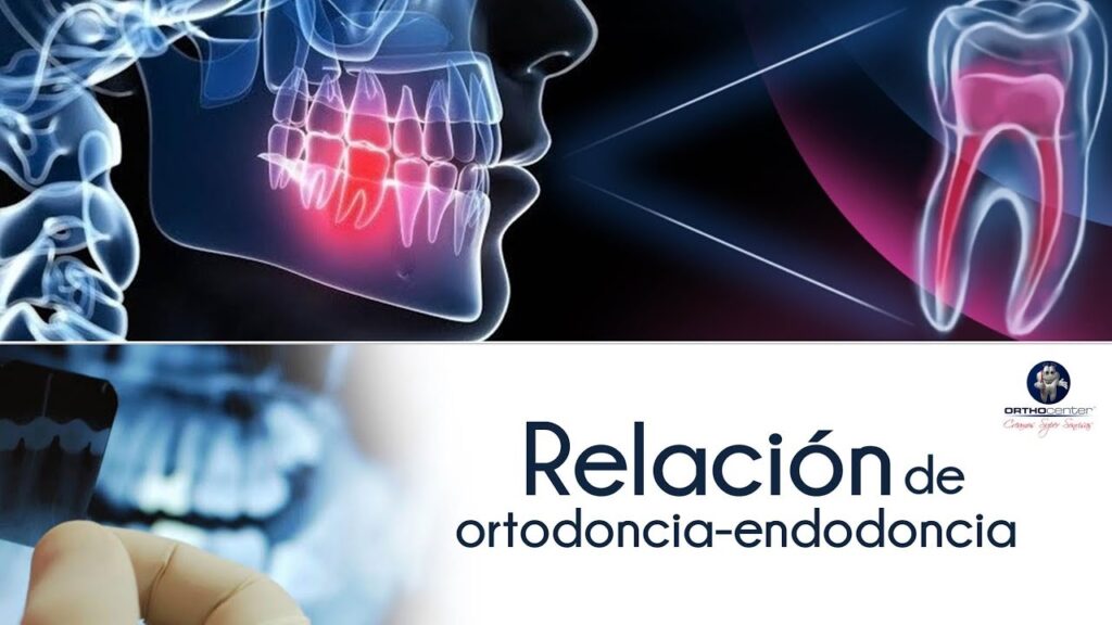 diferencias entre ortodoncio y endodoncia