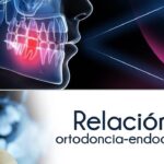 diferencias entre ortodoncio y endodoncia