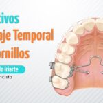 dispositivos de anclaje temporal en ortodoncia milanuncios