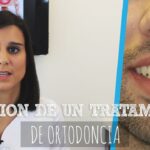 duracion de ortodoncia en adultos