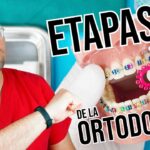 duracipn de las fases ortodoncia juntar dientes