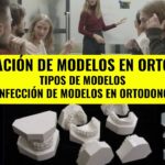 elaboaracion modelos de ortodoncia