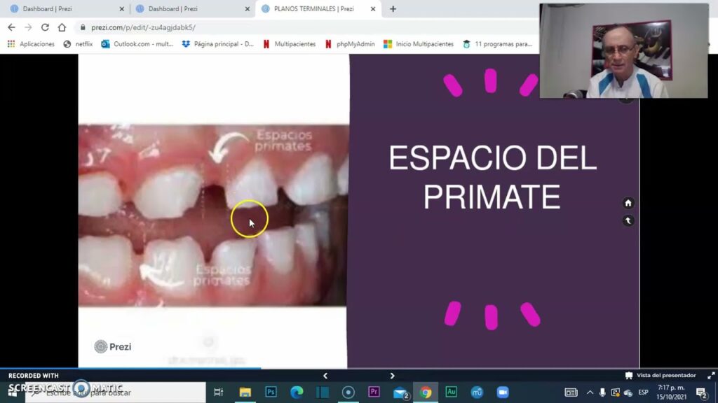 escalon mesial distal y recto ortodoncia