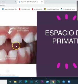 escalon mesial distal y recto ortodoncia