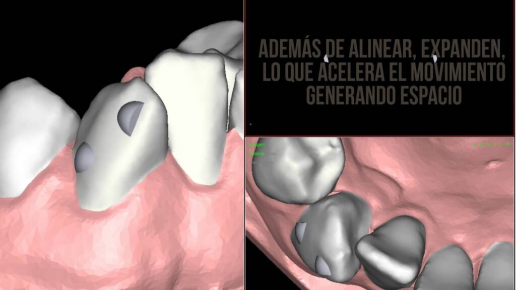 esmeralda herrero especialista en ortodoncia onda