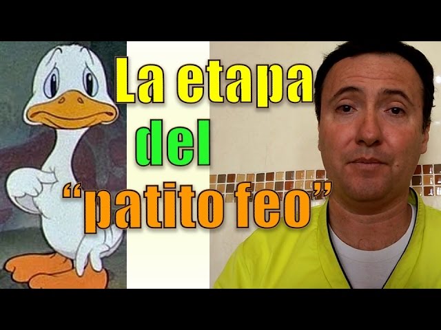 etapa patito feo ortodoncia