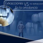 extracciones vs no extracciones en ortodoncia