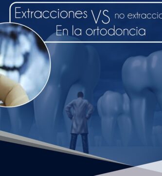 extracciones vs no extracciones en ortodoncia