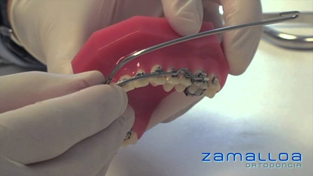 extraoral ortodoncia