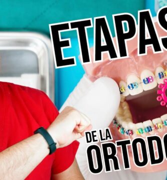 fases tratamiento ortodoncia brakets