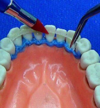 fibras dentales perio y ortodoncia