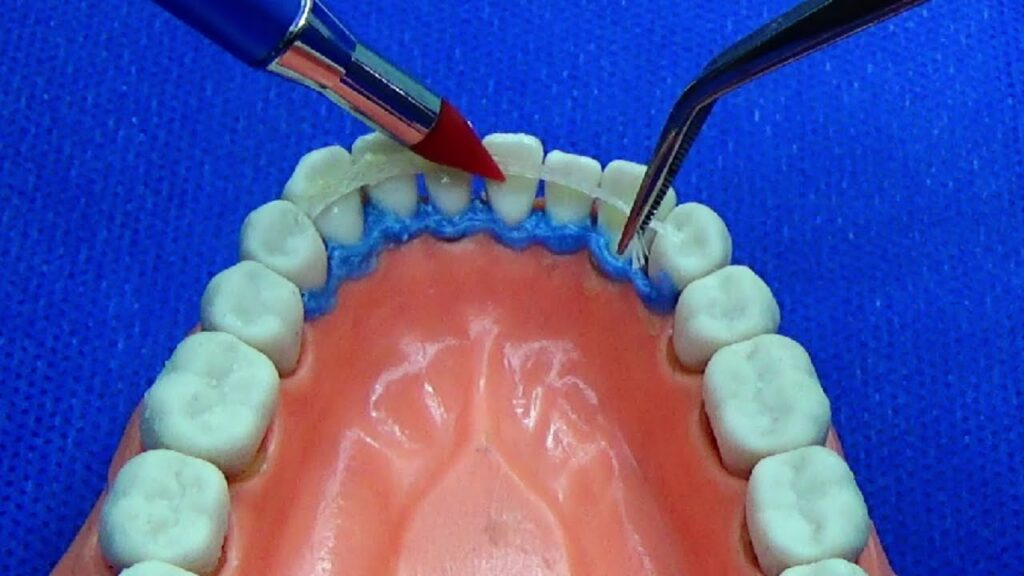 fibras dentales periodoncia y ortodoncia