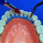 fibras dentales periodoncia y ortodoncia